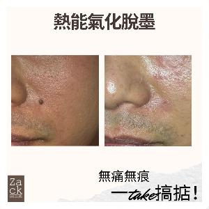 熱能氣化脫墨