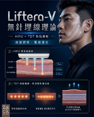 Liftera-V面部緊緻提升療程-體驗價